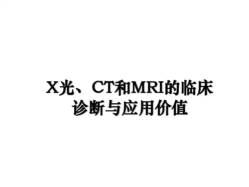 最新X光、CT和MRI的临床诊断与应用价值课件PPT