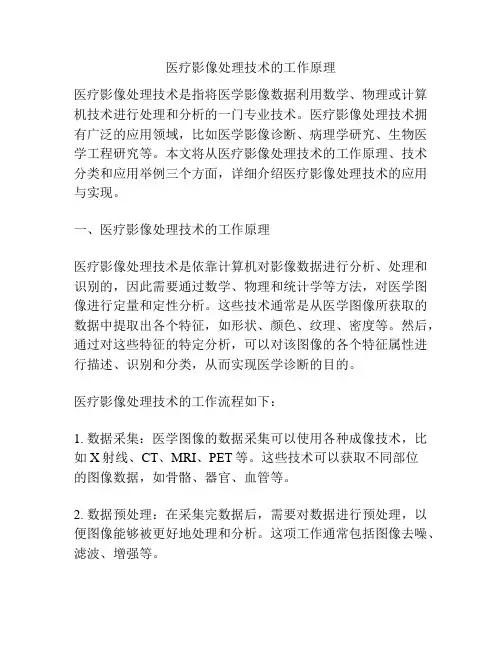 医疗影像处理技术的工作原理