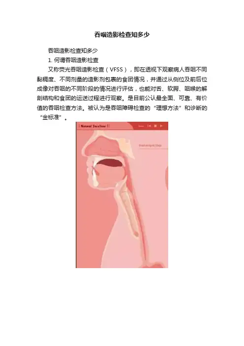 吞咽造影检查知多少