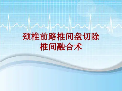 手术讲解模板：颈椎前路椎间盘切除椎间融合术