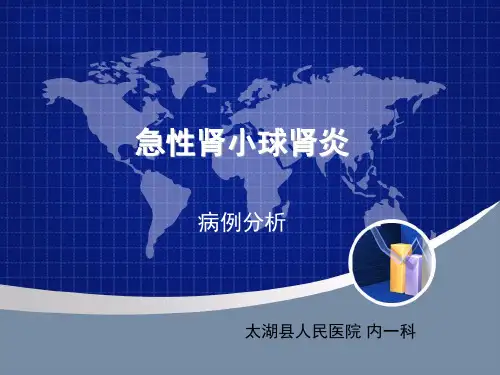 急性肾小球肾炎 (1)
