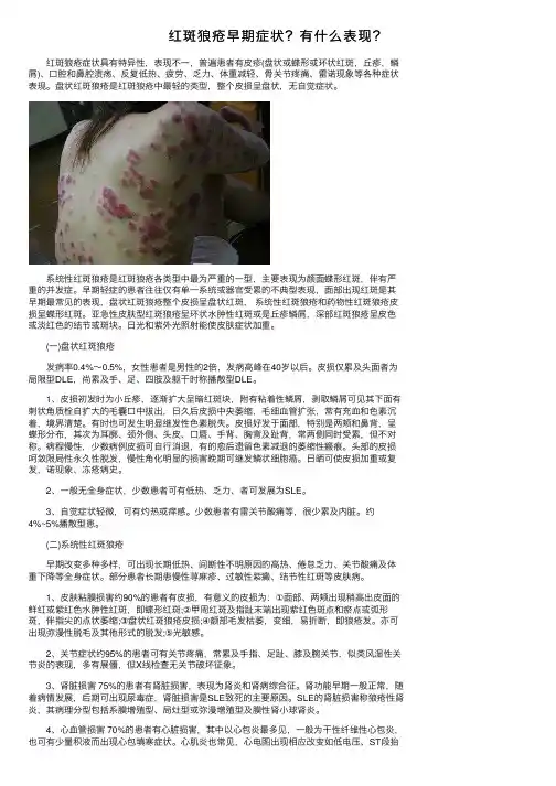 红斑狼疮早期症状？有什么表现？