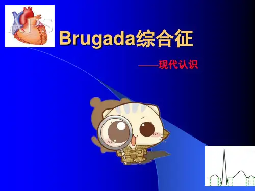 Brugada综合征医学PPT课件