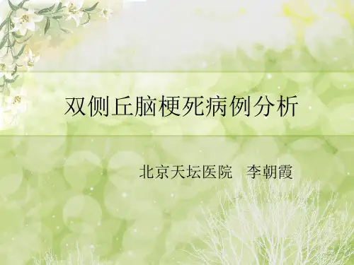 双侧丘脑梗死