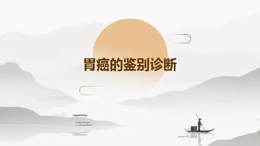 胃癌的鉴别诊断