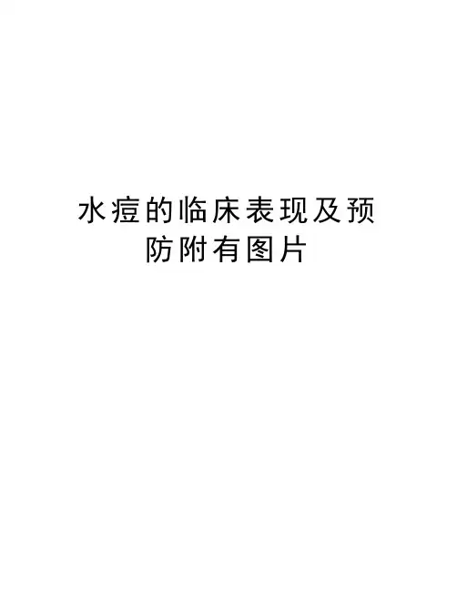 水痘的临床表现及预防附有图片培训讲学