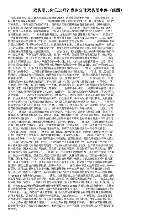 双头婴儿你见过吗？盘点全球双头婴事件（组图）
