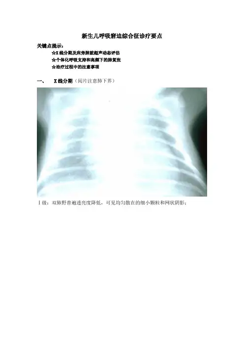 新生儿呼吸窘迫综合征诊疗要点