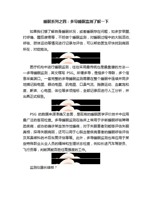睡眠系列之四：多导睡眠监测了解一下