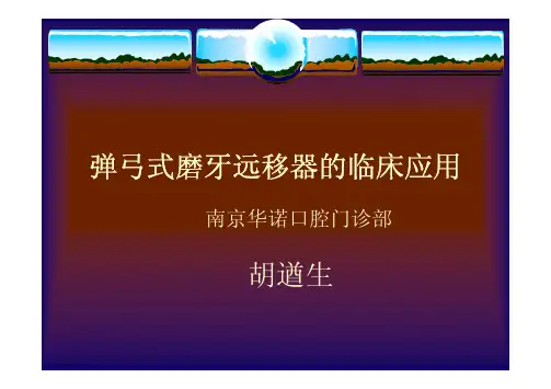 弹弓式磨牙远移器(1)