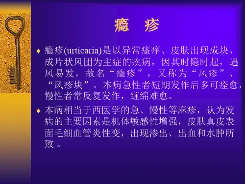 瘾 疹