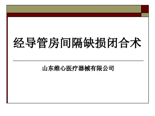 ASD介绍