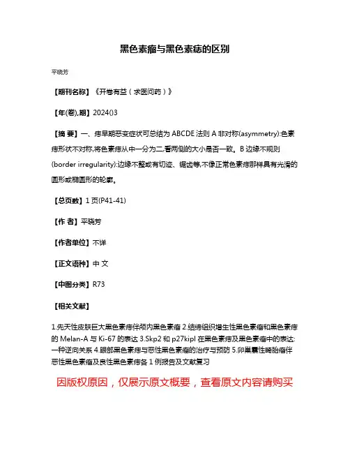 黑色素瘤与黑色素痣的区别