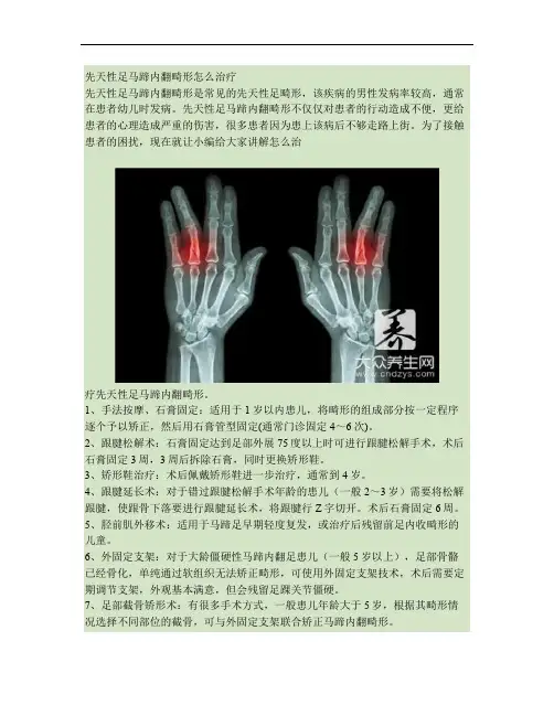 先天性足马蹄内翻畸形怎么治疗(精)