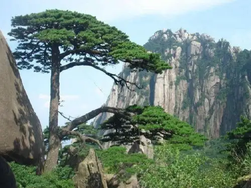 肺循环异常的影像学表现