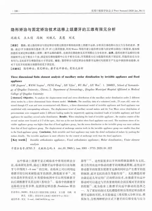 隐形矫治与固定矫治技术远移上颌磨牙的三维有限元分析