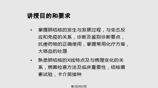 肺结核讲课PPT课件