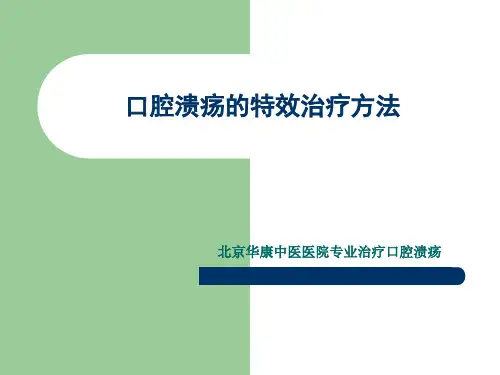 口腔溃疡的特效治疗方法(精)