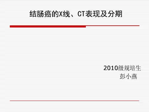 医学影像-结肠癌的X线、CT表现及分期