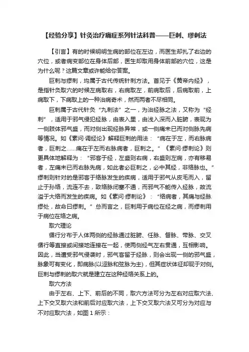 【经验分享】针灸治疗痛症系列针法科普——巨刺、缪刺法