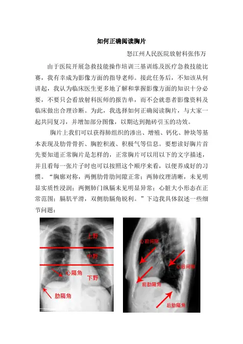 如何阅读胸片解读
