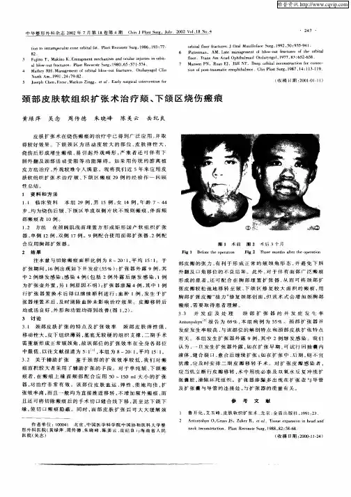 颈部皮肤软组织扩张术治疗颏、下颌区烧伤瘢痕