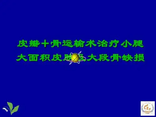 皮瓣 骨运输术治疗小腿大面积皮肤及大段骨缺损大面积皮肤及大段骨缺损ppt课件
