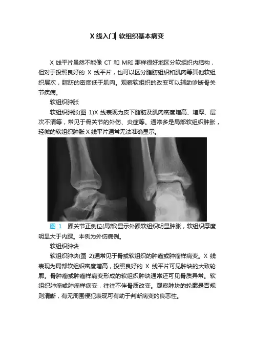 X线入门▎软组织基本病变