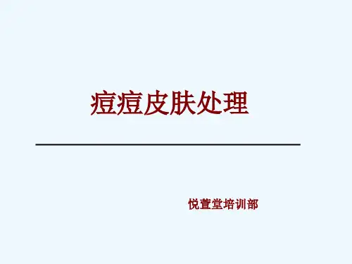 痘痘肌肤处理 PPT