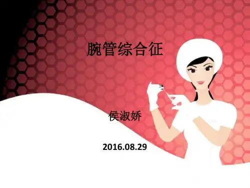 腕管综合征