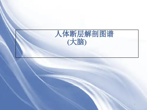 人体断层解剖图谱大脑头颅脑冠状位解剖示意图ppt课件