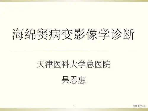 海绵窦病变影像学诊断