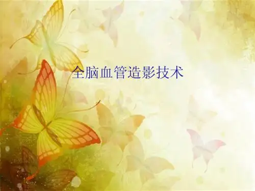 全脑血管造影技术