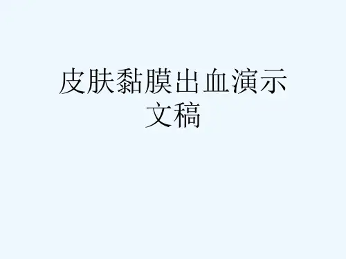 皮肤黏膜出血演示文稿