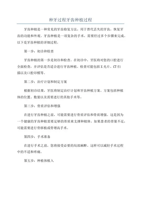 种牙过程牙齿种植过程
