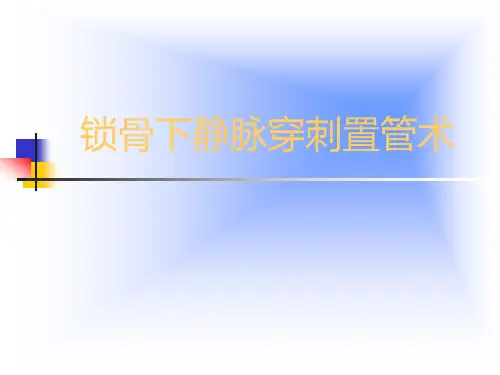 锁骨下静脉穿刺置管术PPT课件