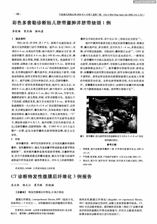 CT诊断特发性腹膜后纤维化3例报告