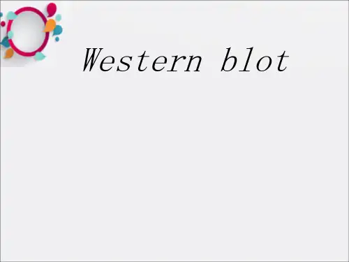 Western blot 的由来,原理,步骤,帮你理解