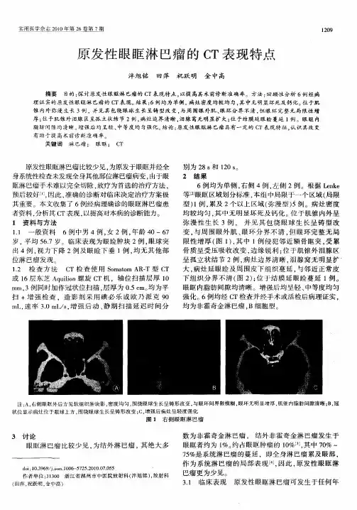 原发性眼眶淋巴瘤的CT表现特点