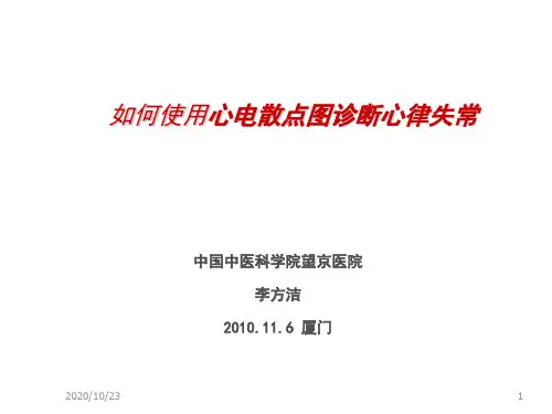 推荐-如何用心电散图分析心律失常课件 精品