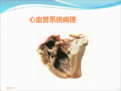 心血管系统病理 ppt课件