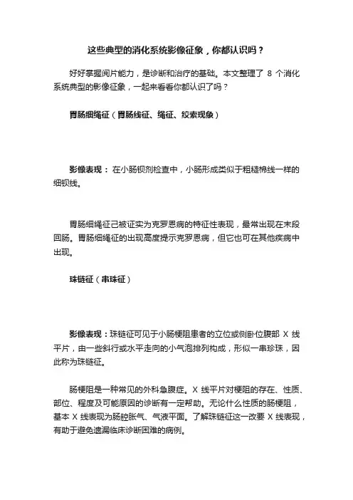 这些典型的消化系统影像征象，你都认识吗？