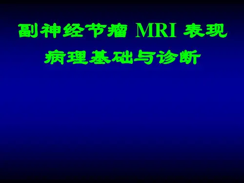 副神经节瘤_MRI_表现病理基础与诊断