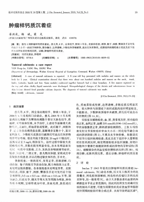 肿瘤样钙质沉着症