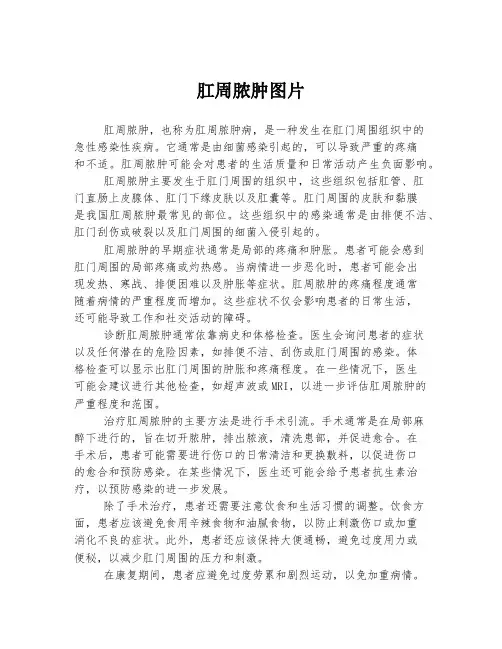 肛周脓肿图片