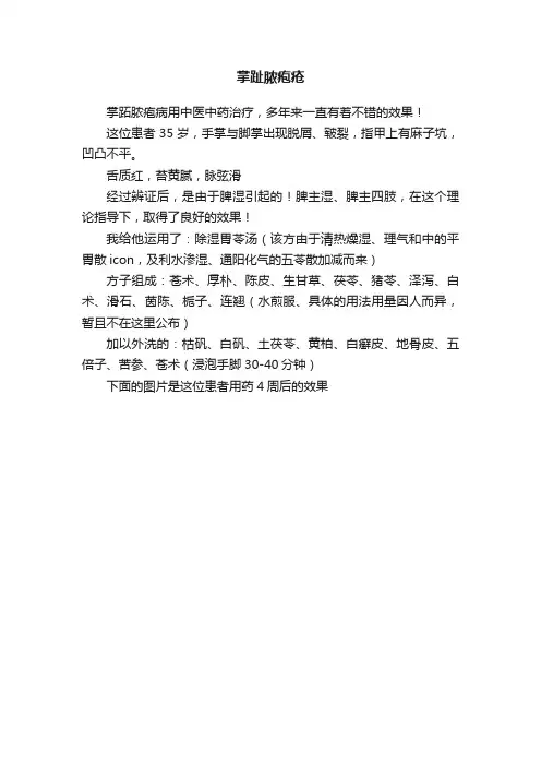 掌趾脓疱疮