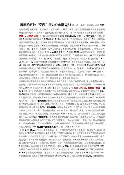 心电图QRS波群的五种