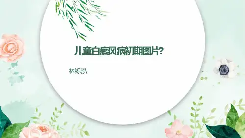 儿童白癜风病初期图片？
