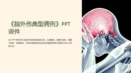 《脑外伤典型病例》课件
