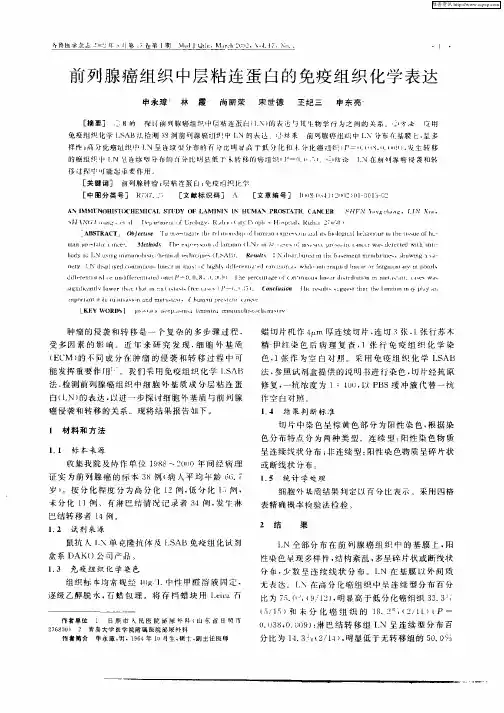 前列腺癌组织中层粘连蛋白的免疫组织化学表达